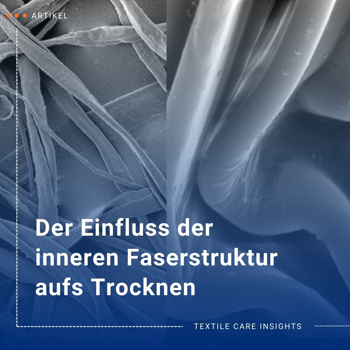 internal-fibre-structure-teaser-de