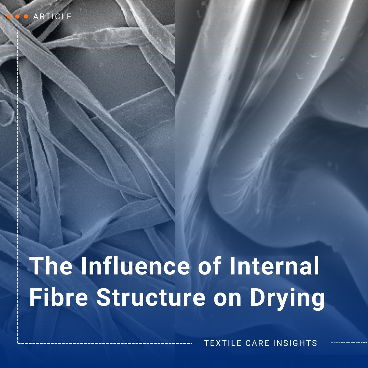 internal-fibre-structure-teaser-en